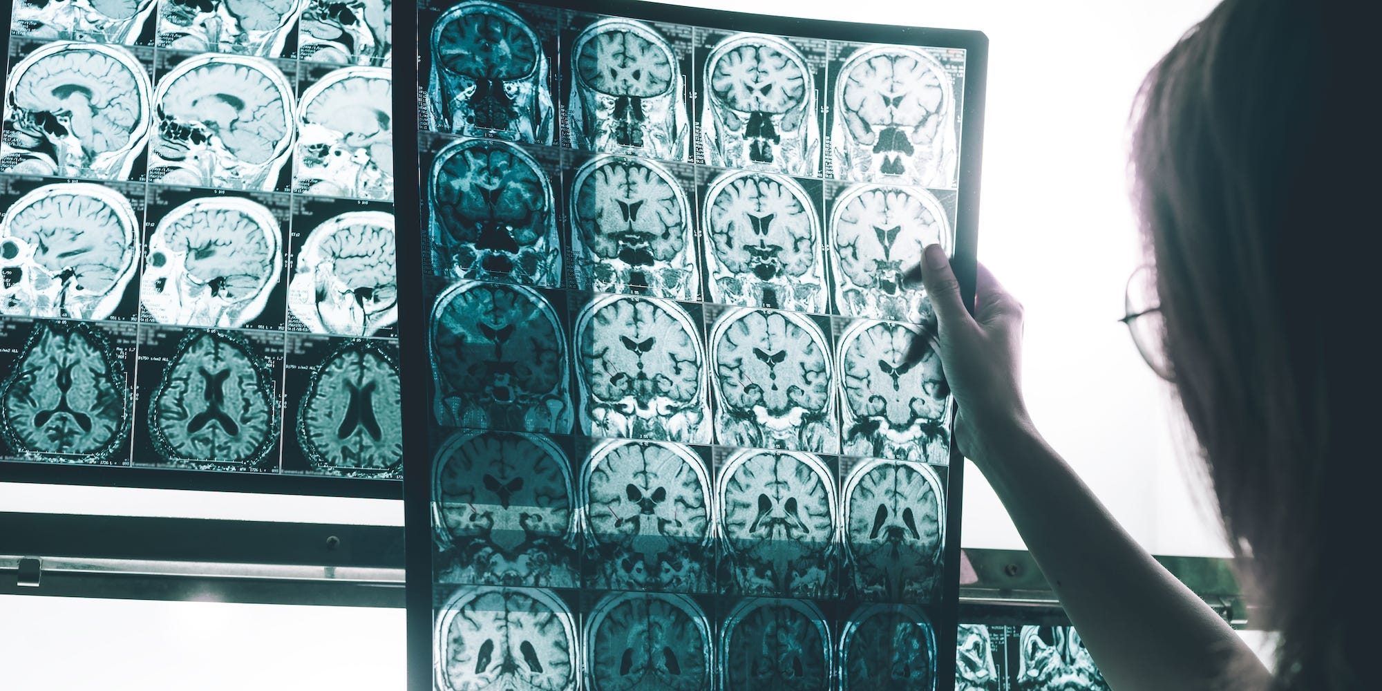 A doctor observes medical scans of a patient's brain.